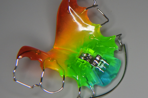 Kieferorthopädie abnehmbar