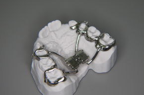 Kieferorthopädie festsitzend